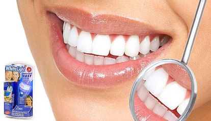Скидка 50% на домашние системы отбеливания зубов White Light